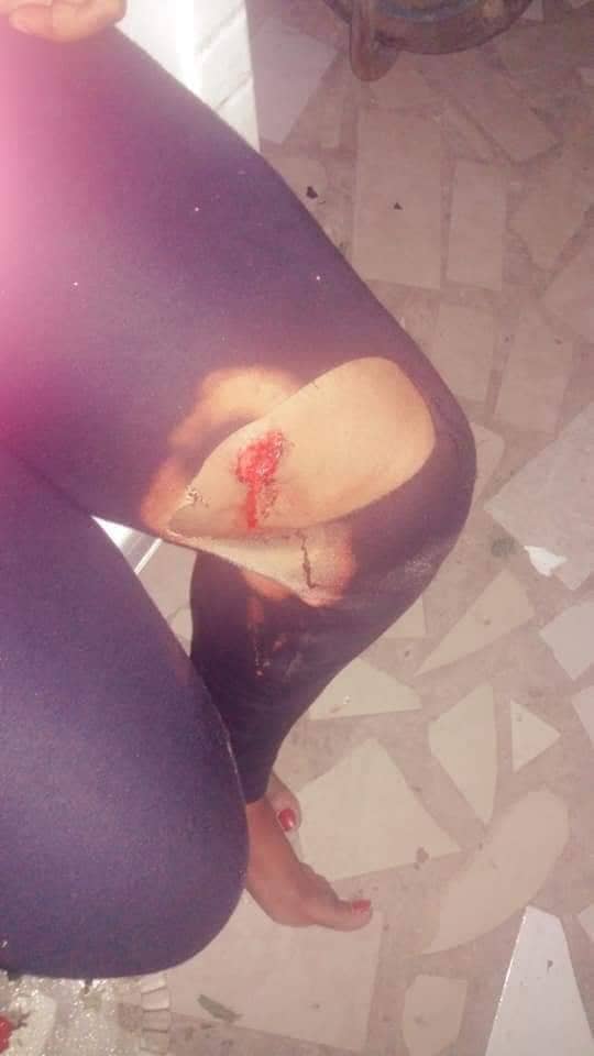 Une jeune fille agressée au couteau à IAI en plein réveillon de noël