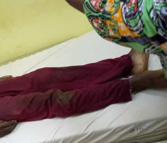 Il poignarde à mort son condisciple de classe à Tchibanga
